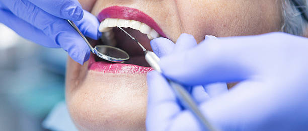 Best Emergency Wisdom Teeth Removal in Electra, TX